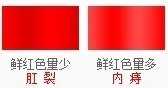 便血1