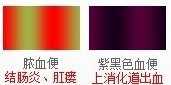 脓血便